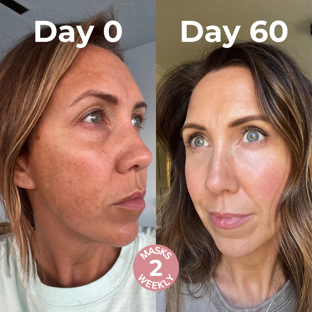 Glow Up Mask (Flash Sale) - Image 5