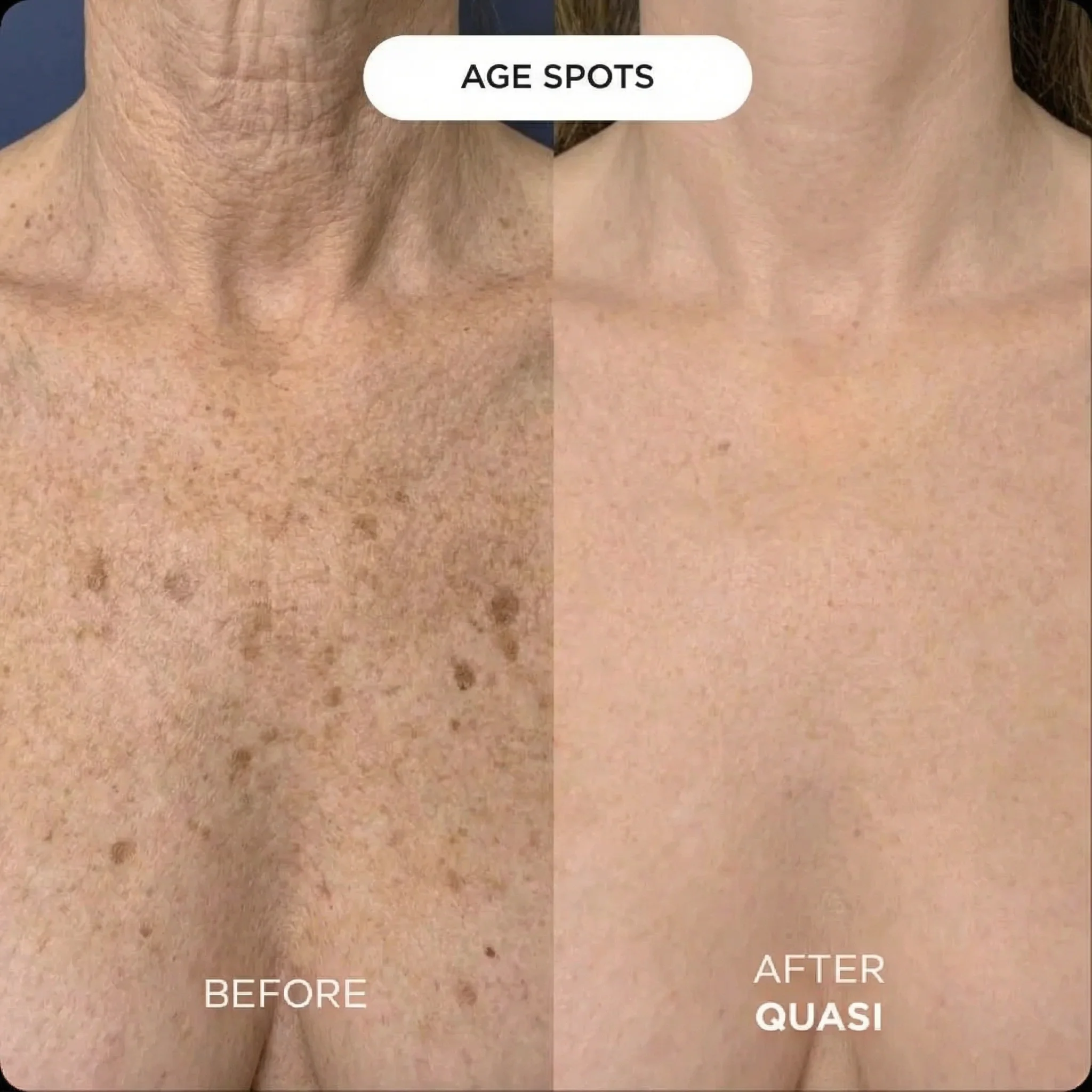 Collagen Chest Mask - Image 5