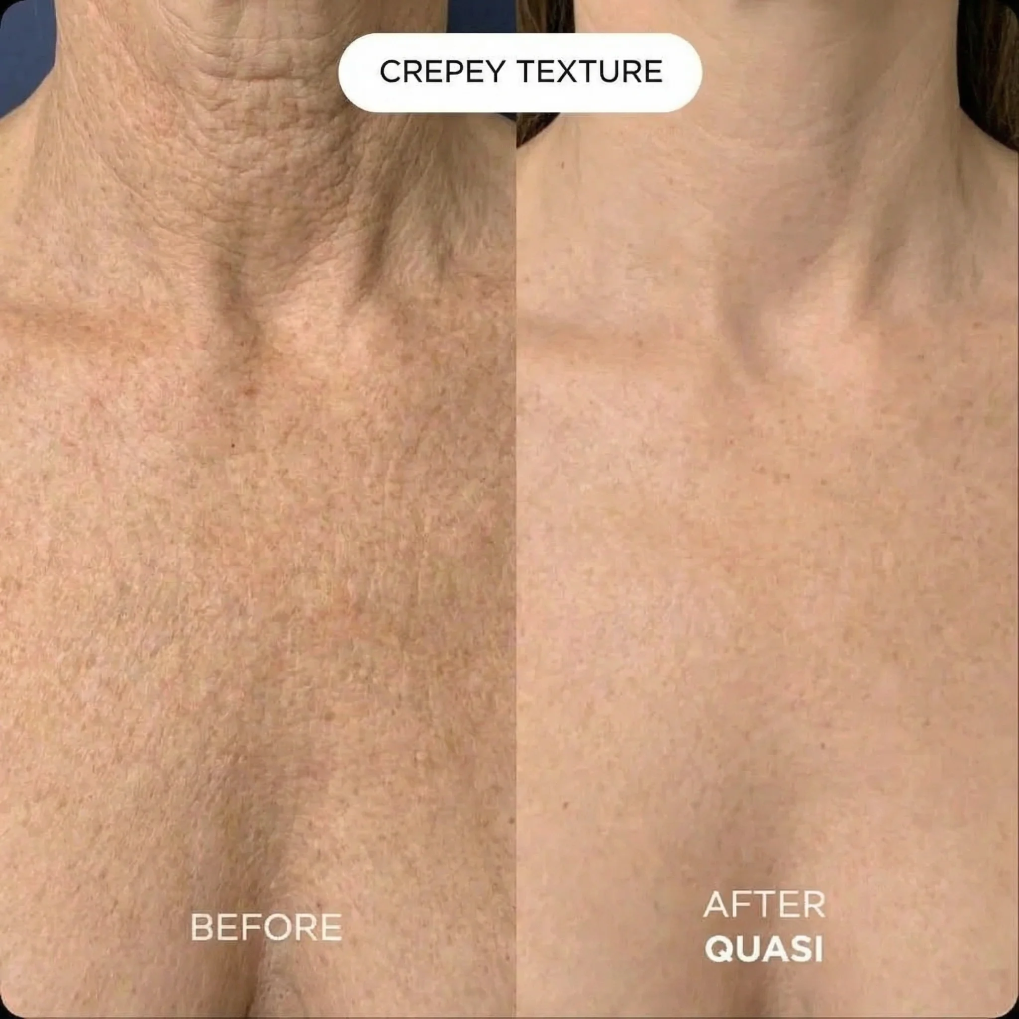 Collagen Chest Mask - Image 6