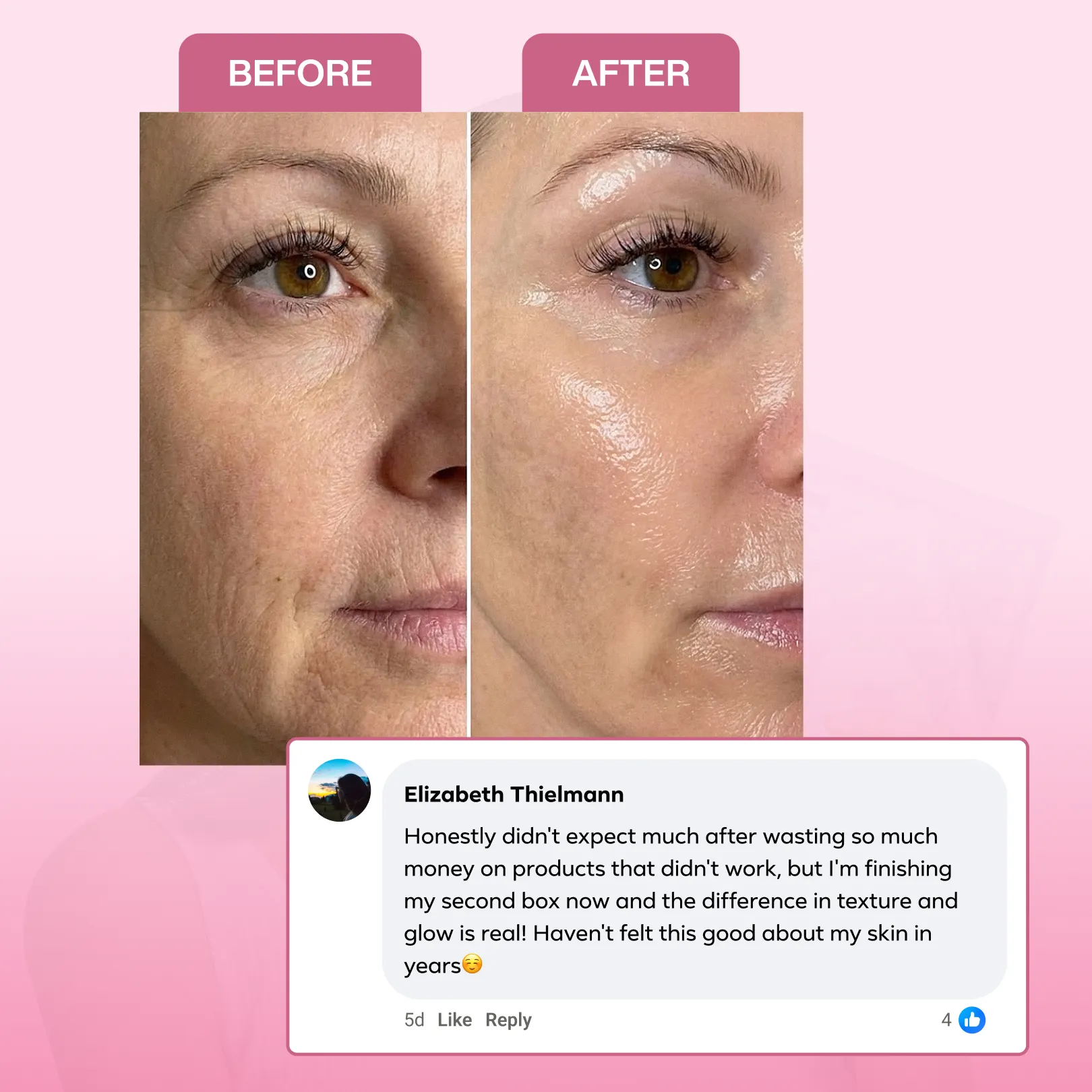 Collagen Mask Bundle - Image 7