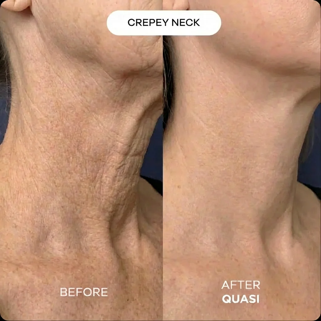 Collagen Neck Mask - Image 5