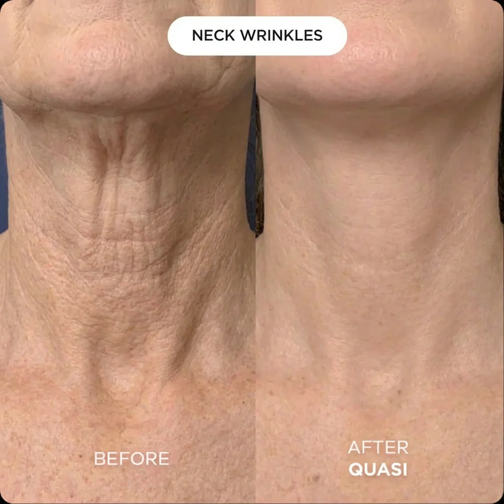 Collagen Neck Mask - Image 6